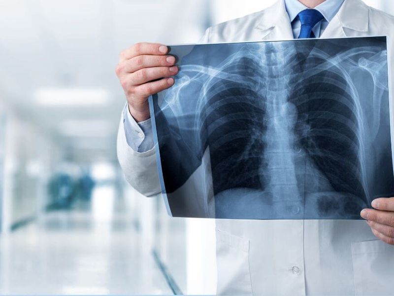 Pruebas de diagnóstico por imagen: Tipos Pruebas de diagnóstico por imagen: Tipos