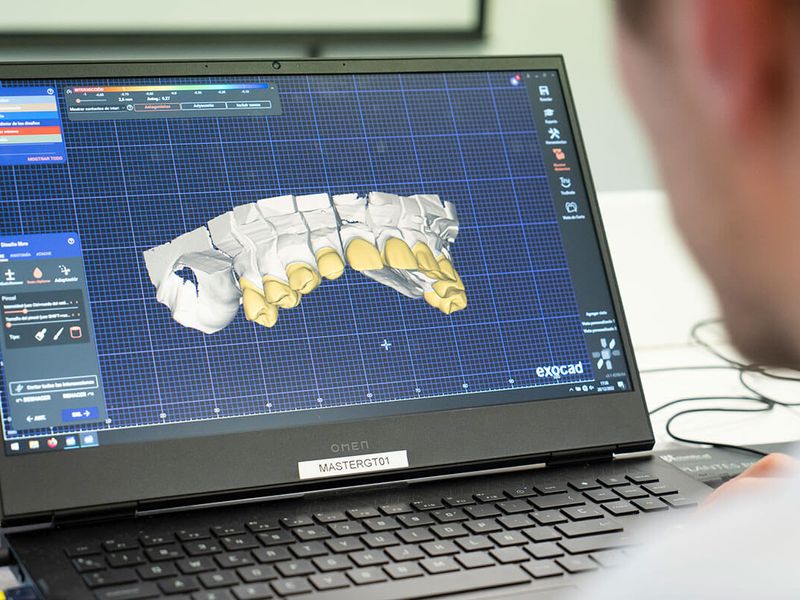 grado superior higiene bucodental semipresencial