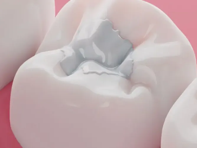 Clasificación de black: ¿Qué significa? Clasificación de black: ¿Qué significa?