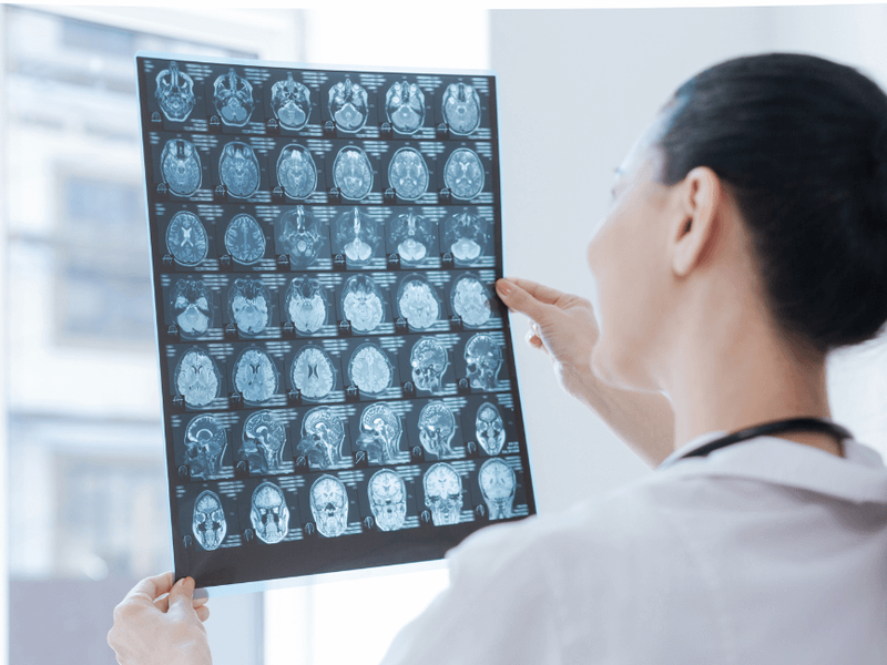 Carrera de Radiología: Tu plan de futuro, a escáner