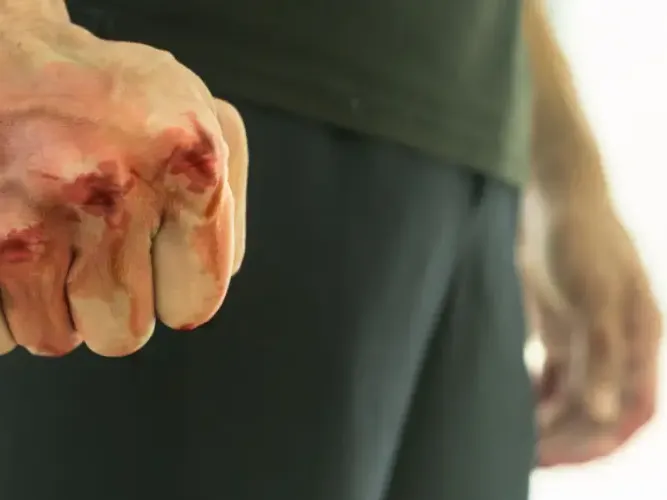 heridas heridas