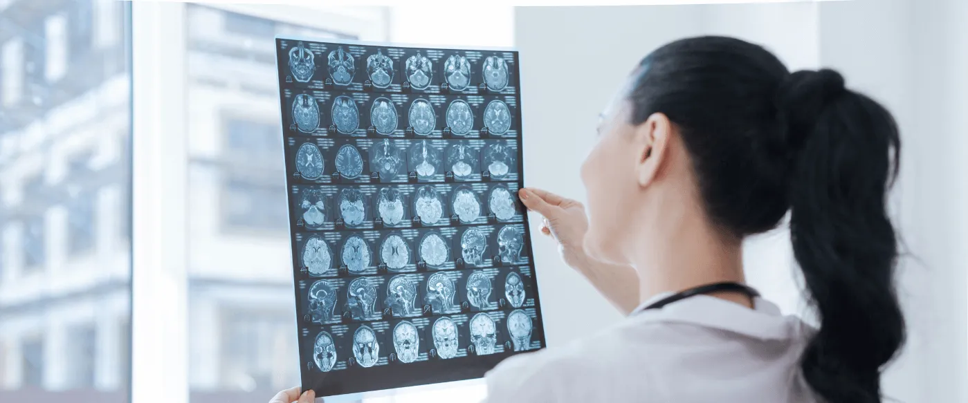 Blog Cesur Formación | Carrera De Radiologia A Escaner