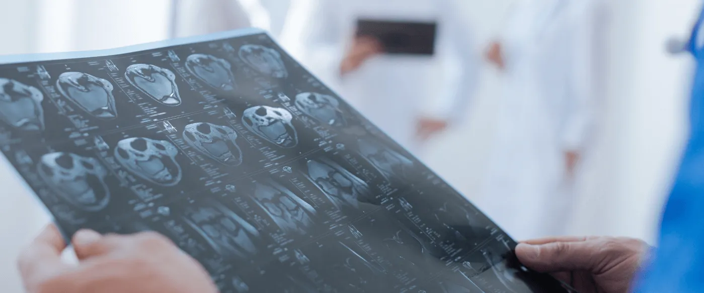 Blog Cesur Formación | Donde Y Como Estudiar Radiologia