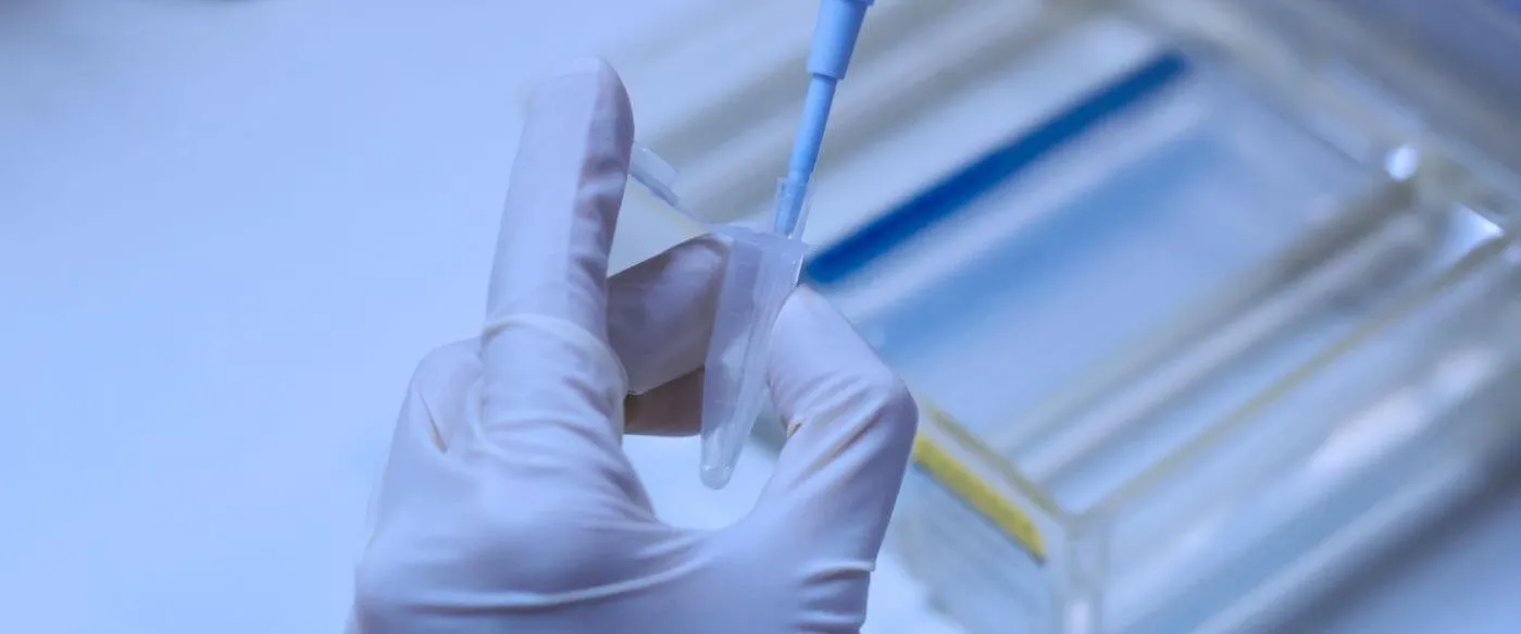 Blog Cesur Formación | Tipos De Electroforesis