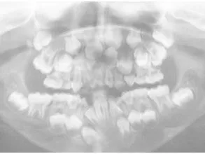 Alteraciones Esqueleticas